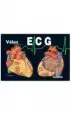 AudioLibro E.C.G. Electrocardiografia (3ª Ed.) de Velez