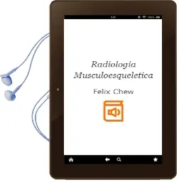 Descargar AudioLibro Radiologia Musculoesqueletica de Felix Chew año 2005