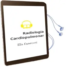 Descargar AudioLibro Radiologia Cardiopulmonar de Ella Kaserooni año 2006