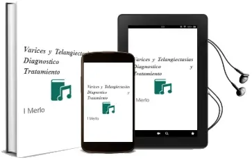 Descargar AudioLibro Varices y Telangiectasias. Diagnostico y Tratamiento de I. Merlo año 2007
