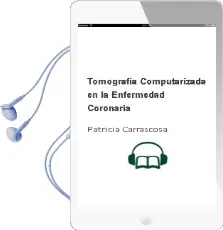 Descargar AudioLibro Tomografia Computarizada en la Enfermedad Coronaria de Patricia Carrascosa año 2008