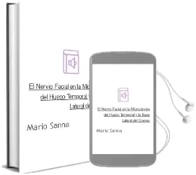 Descargar AudioLibro El Nervio Facial en la Microcirugia del Hueso Temporal y la Base Lateral del Craneo de Mario Sanna año 2008