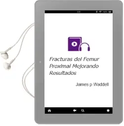 Descargar AudioLibro Fracturas del Femur Proximal. Mejorando Resultados de James P. Waddell año 2013
