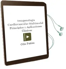 Descargar AudioLibro Imagenologia Cardiovascular Multimodal. Principios y Aplicaciones Clinicas de Olle Pahlm año 2014